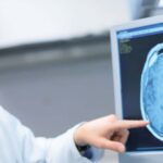 Cleveland Clinic neurologist says virtual second opinions fill a widening gap